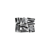 Roylco Broken Bones X-Rays-Age group and grade: Ages 5+ and grades pre school - 12th